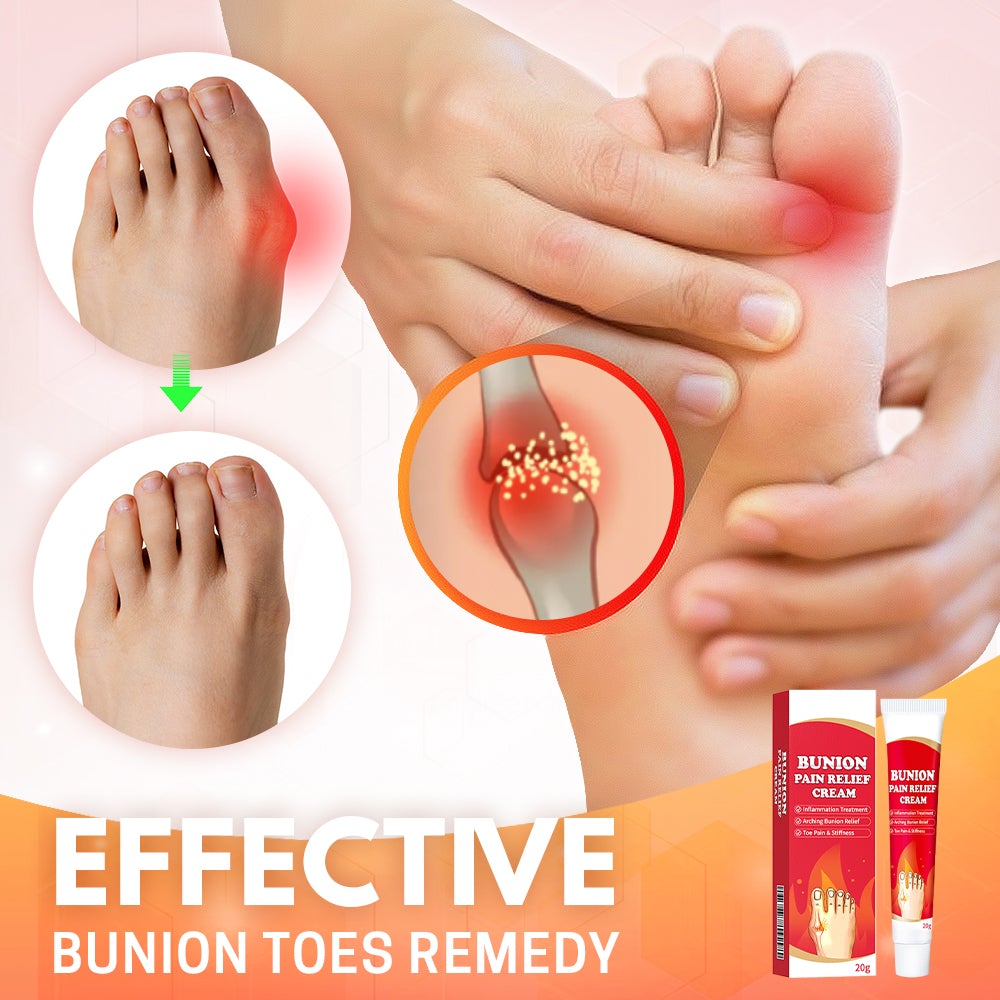 Bunion Toe Relief Cream